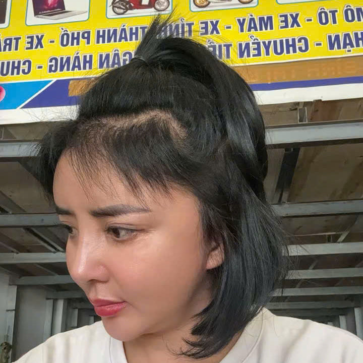 After treatment
