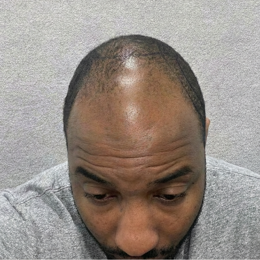 Before treatment