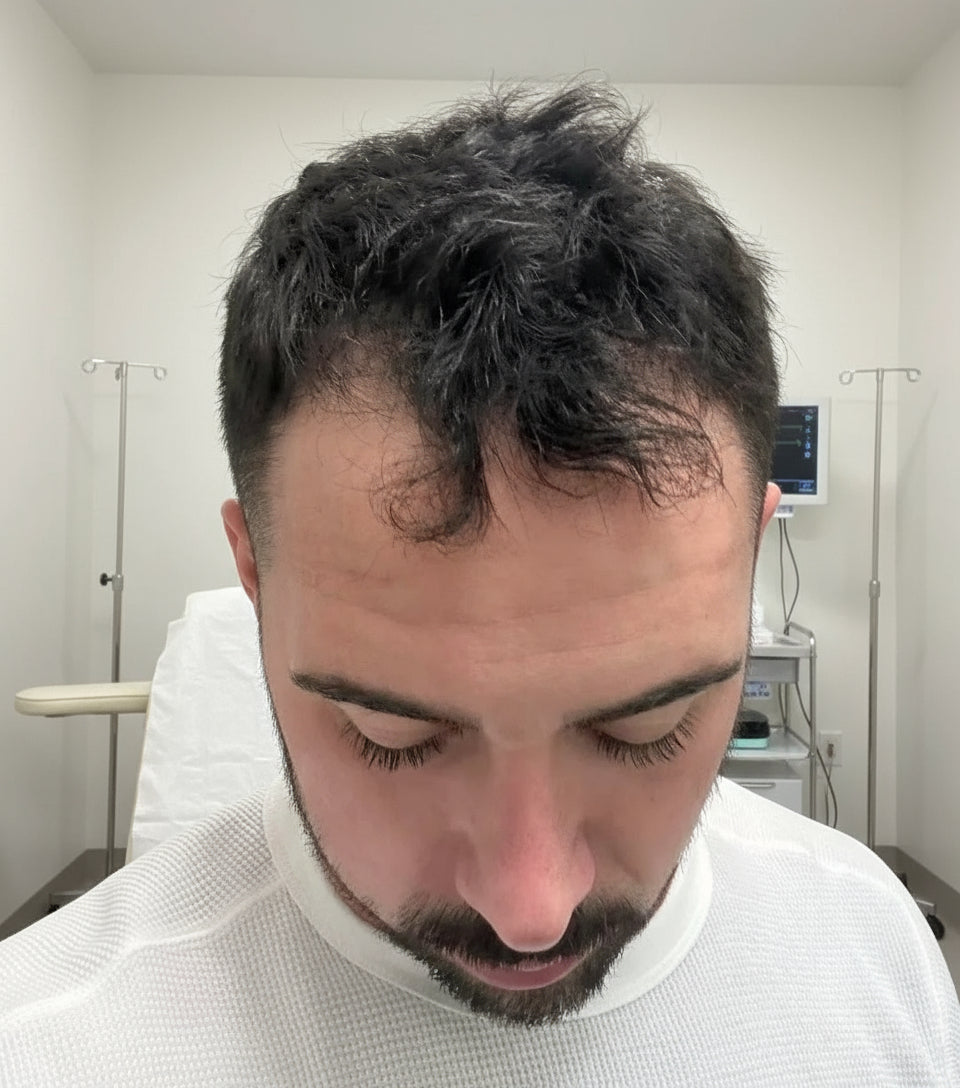 Before treatment