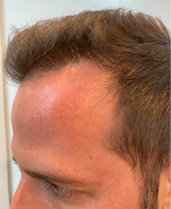 Close-up of a person's head with hair and skin visible